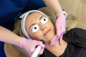 Rejuvenate Your Skin with PRF Injections